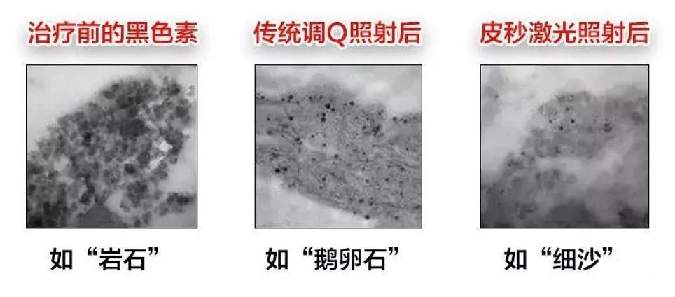 祛斑骗局骗术_骗局祛斑美容院是真的吗_美容院祛斑骗局