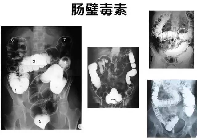 经络代谢减肥骗局_代谢减肥法对身体有伤害吗_经络代谢减肥原理